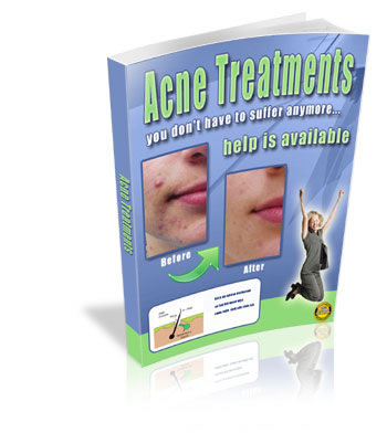 Acne Treatments eBook