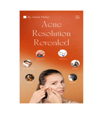Acne Resolution Revealed eBook